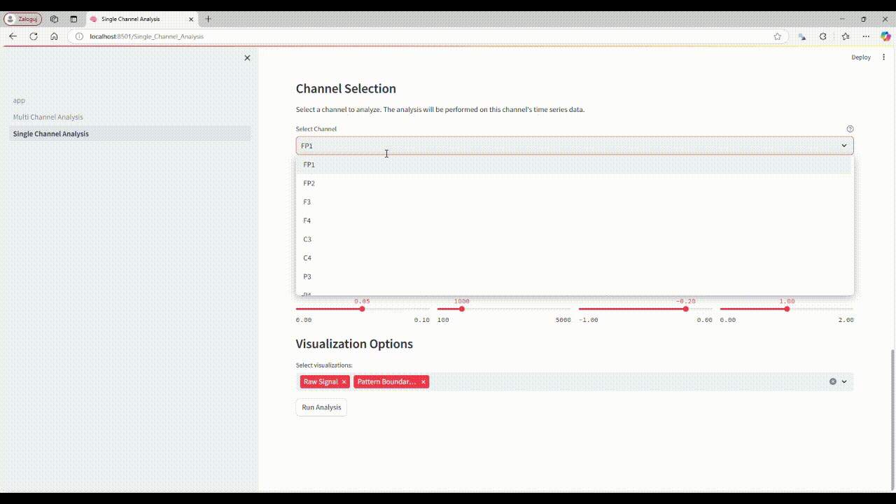 EEG AI Data Model Visualization